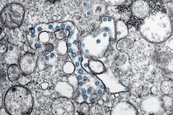 coronavirus