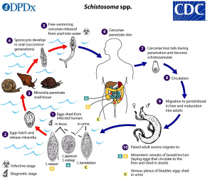 Schistosomiasis